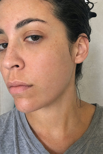 Skin after the shower — week 3